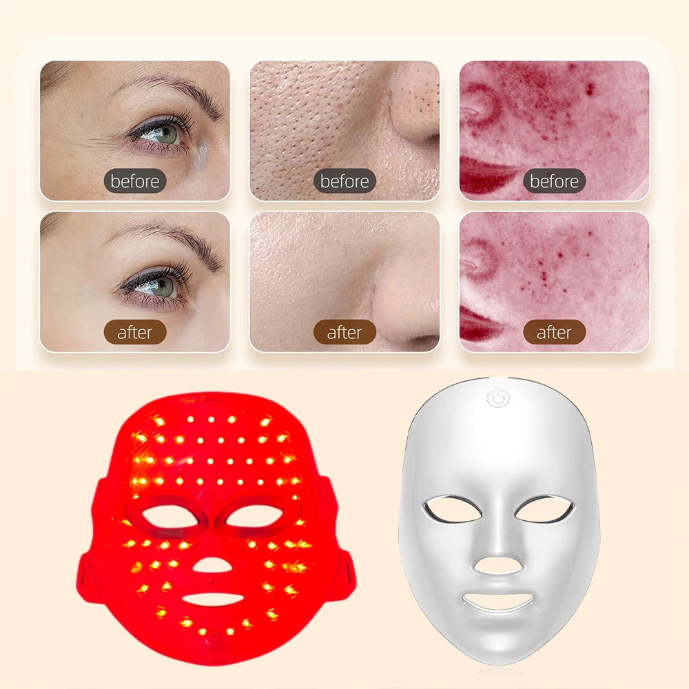 LED Glow Mask: tu Rutina de Cuidado Facial con 7 Colores de Luz ✨